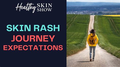 Managing Skin Rash Journey Expectations Jennifer Fugo Youtube