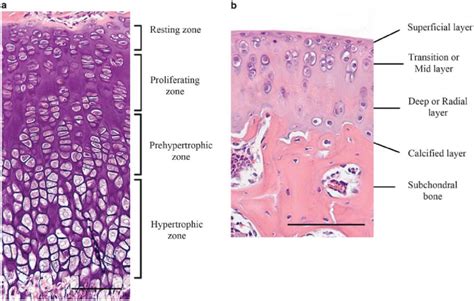 Histology Of Growth Plate A And Articular Cartilage B Of The