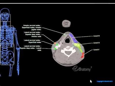 The lymph nodes in the neck have historically been divided into at least six anatomic neck lymph node levels for the purpose of head and neck cancer staging and therapy planning. eAnatomy - Head & Neck Lymph Nodes.wmv - YouTube