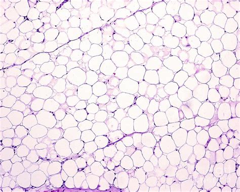 Adipose Tissue Photograph By Jose Calvo Science Photo Library Fine