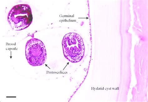 Photomicrograph Of A Section Through An Echinococcus Granulosus Cyst