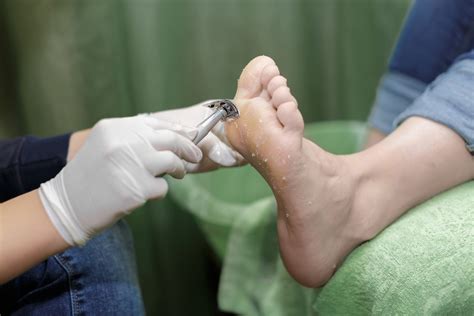 5 Reasons Why You Should See A Podiatrist Instep Podiatry Brisbane