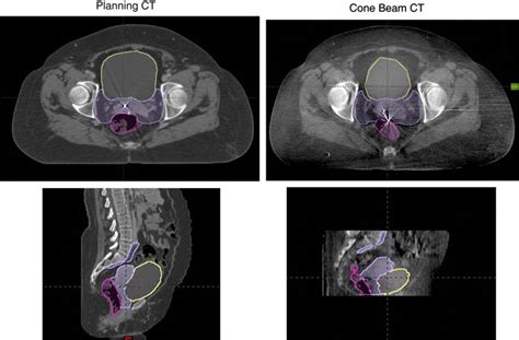 Cone Beam Ct Radiotherapy The Best Picture Of Beam
