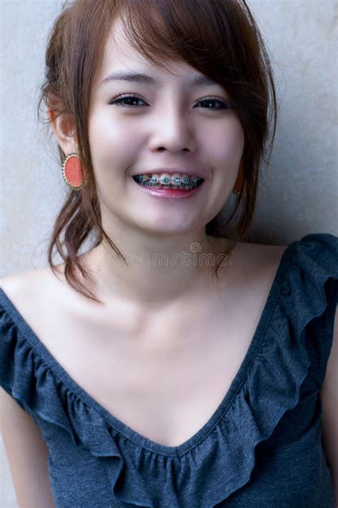 Asian Braces Girl Smile Stock Image Image Of Asian Chinese 23057071