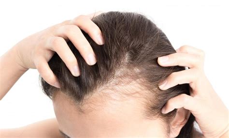 6 Conseils Pour Lutter Efficacement Contre La Chute De Cheveux