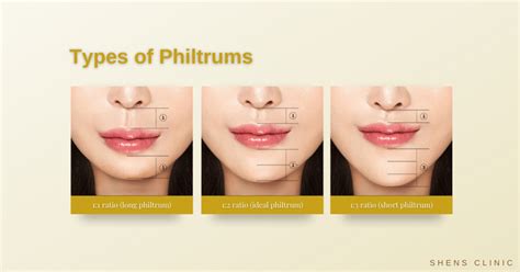 Philtrum Reduction And Contouring Upper Lip Lift Shens Clinic