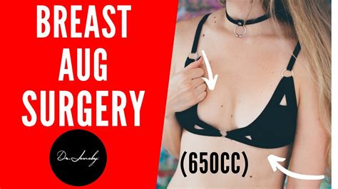 breast augmentation 650 cc breast augmentation dr jeneby houston dallas austin san