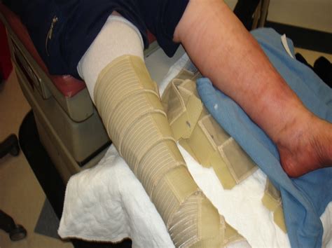 Compression Therapy Woundcare