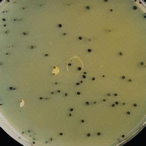 Dec 23, 2020 · escherichia coli (e. Perfringens Agar (TSC) - Lab M