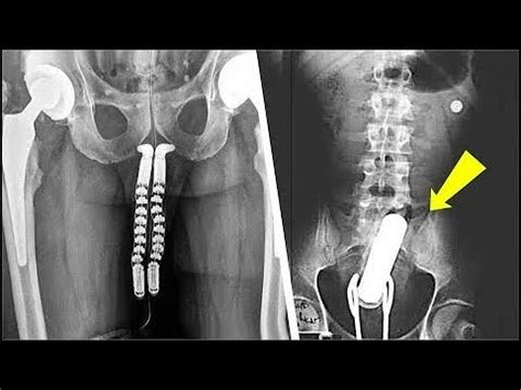 Strangest Things Discovered By X Rays Youtube