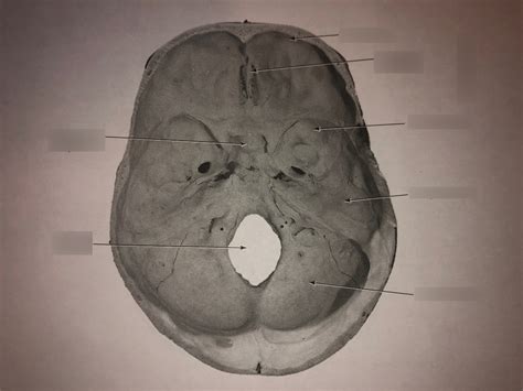 Skull Superior View Of Cranium Floor Diagram Quizlet