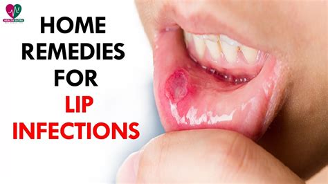 Home Remedies For Of Lip Infections Health Sutra Youtube