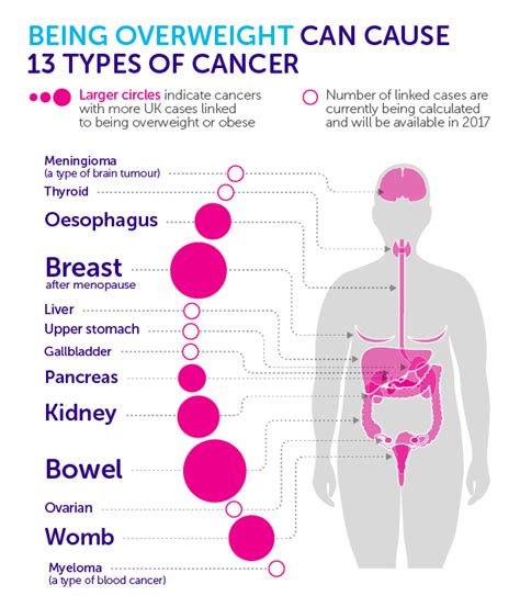 Obesity And Risk Of Cancer The Trend Is Disastrous Millennium Cancer Center