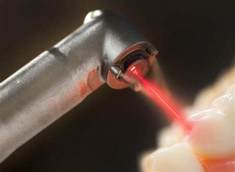 New Infrared Laser Technique Allows Teeth To Regrow And Repa