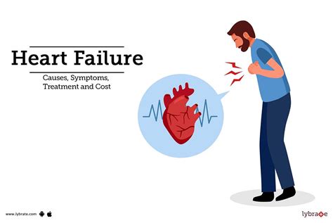 Heart Failure Treatment Procedure Cost Recovery Side Effects And More