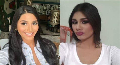 Fotos Del Antes Y Después De Miss Venezuela Se Hacen Virales