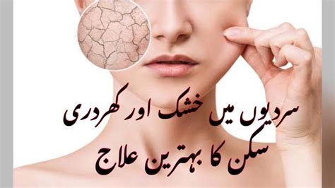 Dry Skin Home Remedy Dry Skin In Winter Dry Skin Ko Smooth Kaise
