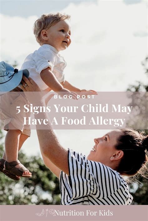 5 Signs Your Child Has A Food Allergy Food Allergies Signs Of Food
