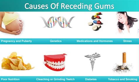 Home Cure For Gum Disease Receding Gums Treatments