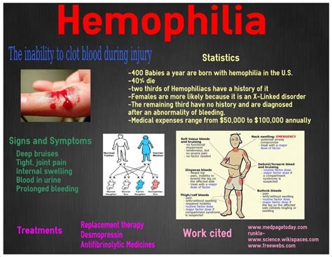 Bij ernstige hemofilie hebben de patiënten vaak bloedingen in de spieren of gewrichten. 1000+ images about Hemophilia on Pinterest | Medical, The ...