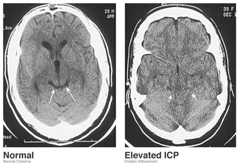 A Systematic Approach To The Interpretation Of Ct Head