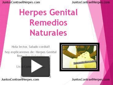 Ppt Herpes Genital Remedios Naturales Powerpoint Presentation Free