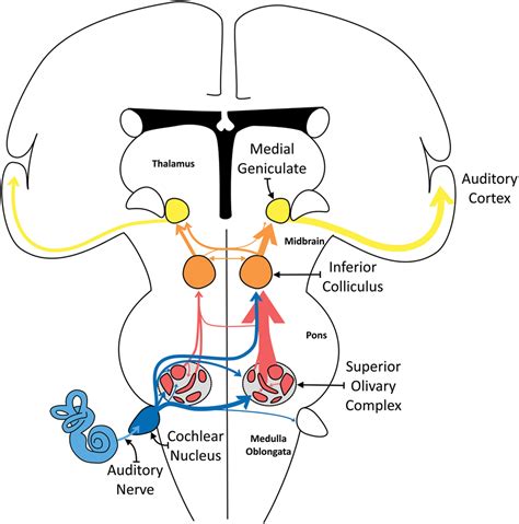 Structural And Functional Aberrations Of The Auditory Brainstem In