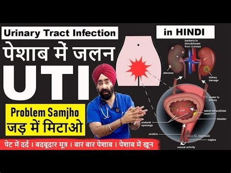 Urinary Tract Infection Cause To Cure Uti Explained In Hindi Dr Education