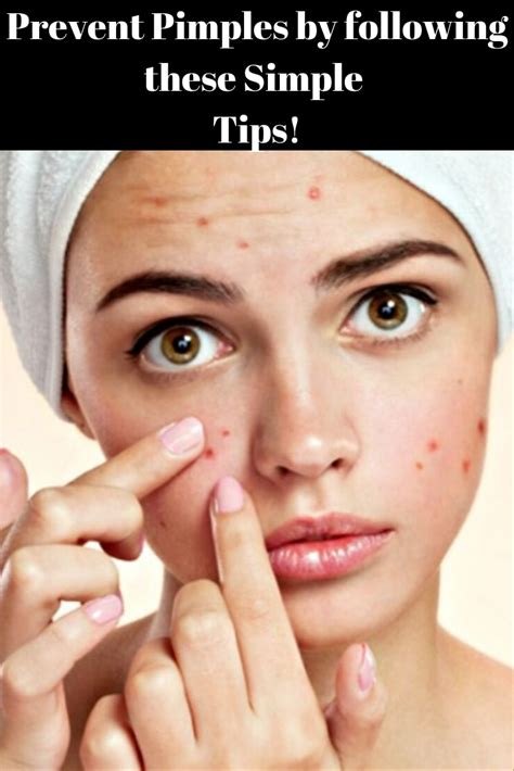 Angies Lifestyle Tips Prevent Pimples By Following These Simple Tips