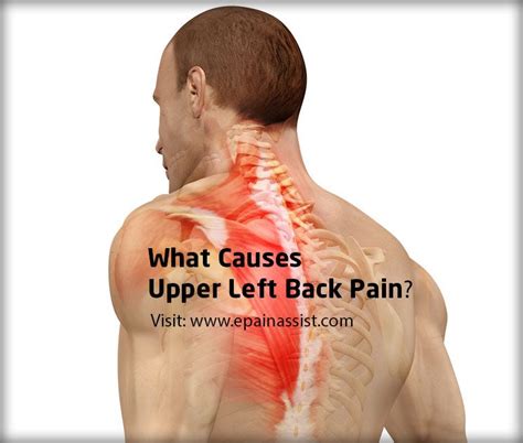 There are many treatments for upper and middle back pain. Pin on Alternative medicine