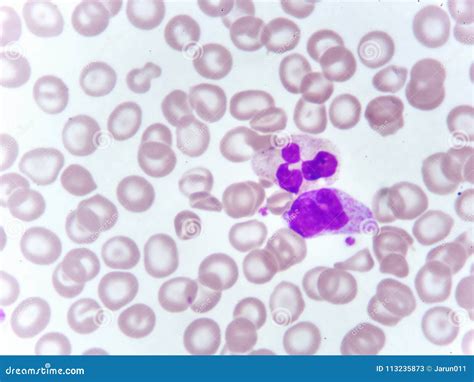 Monocyte And Neutrophil Cell In Blood Smear Stock Image Image Of