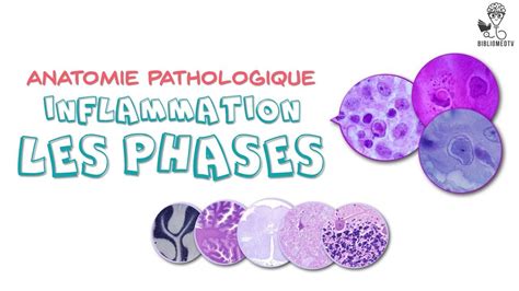 Anatomie Pathologique Phases De Linflammation Youtube
