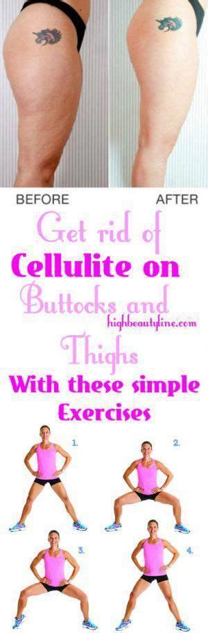 Pin On Cellulite Remedies