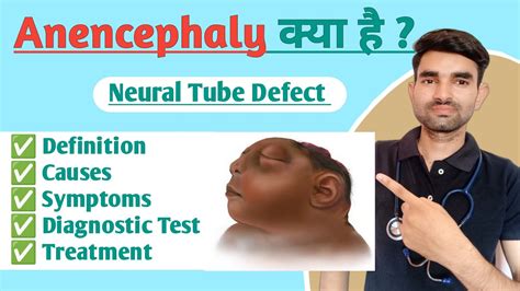 Anencephaly In Hindi Causes Symptoms And Treatment Of Anencephaly