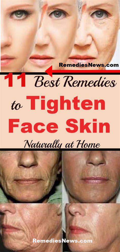 11 Best Remedies To Tighten Face Skin Naturally At Home