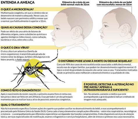 Visada T Tica Microcefalia Zica Virus Chikungunya E Dengue