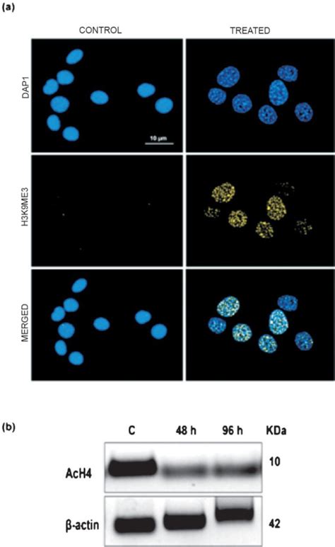 A Sahf Formation Representative Microphotographs Of Open I