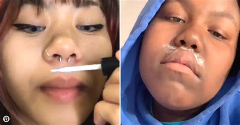 Horrifying New Trend Has People Gluing Their Lips To Make Them Bigger