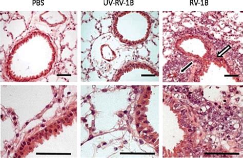Guidelines for the acute respiratory viral infection treatment. Mouse Models of Rhinovirus-induced disease