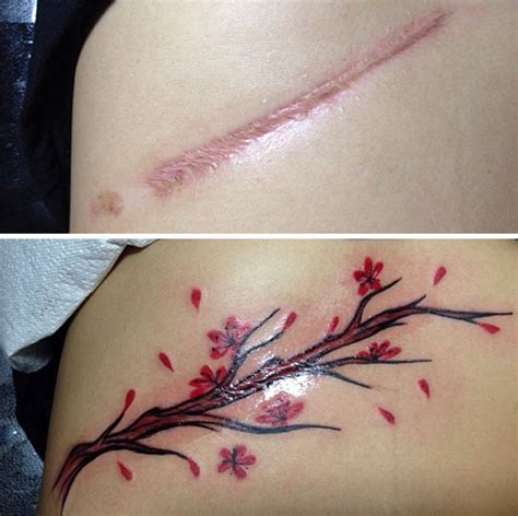 Incredible Scar Tattoo Cover Ups Transforming Imperfections Into Art Today H Com