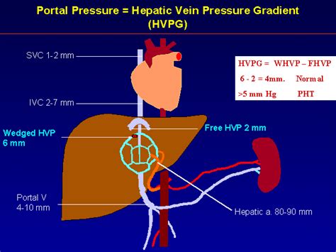 Hepatic Vein Anatomy
