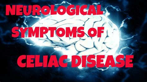 Neurological Symptoms Of Celiac Disease What Are The Neurological
