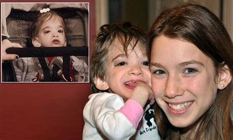 Brooke Greenberg The 20 Year Old Woman With A Rare Genetic Disorder