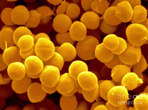 Staphylococcus Saprophyticus Photograph By Scimat Pixels Merch