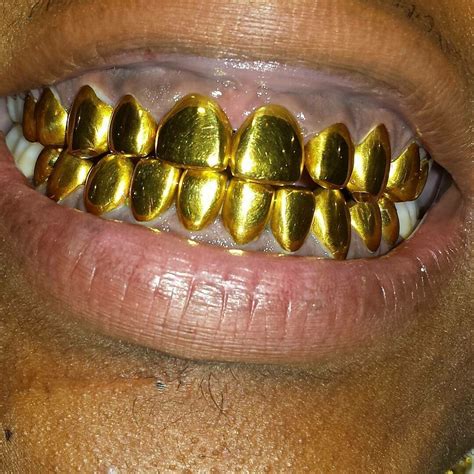 Who Does The Best Permanent Gold Teeth In Florida Katie Washington Hochzeitstorte