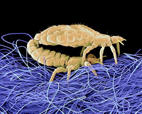 Mating Body Lice Sem Photograph By Volker Steger Fine Art America