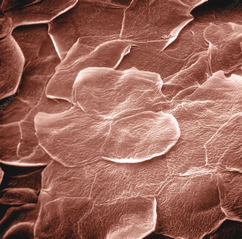 Sem Of Human Skin Stock Image C0283101 Science Photo Library