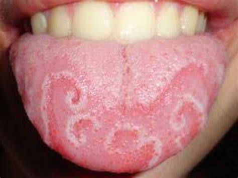 Facts About The Tongue You Might Not Know Owlcation