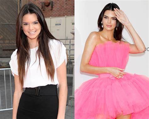 Kendall Jenner Then And Now Photos Hollywood Life