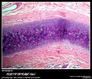 Histology Cartilage My Aimst University Lifestyle Blog